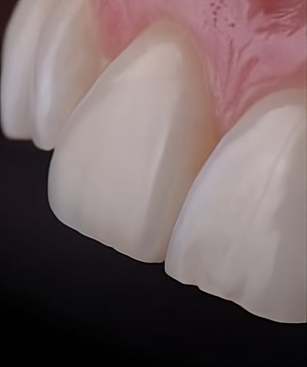 Rotondo Clinic Cometic Dentistry Tooth Repair